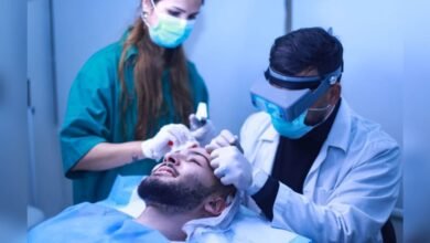 صورة توضيحية - مركز Tito بصمة واضحة في مجال زراعة الشعر
